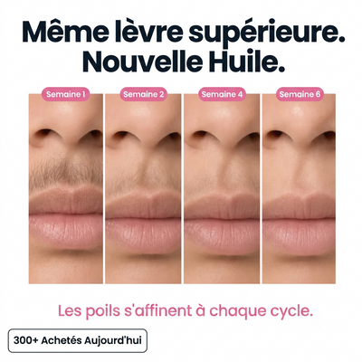 Huile au Cyperus | Repousse Ralentie & Peau Apaisée