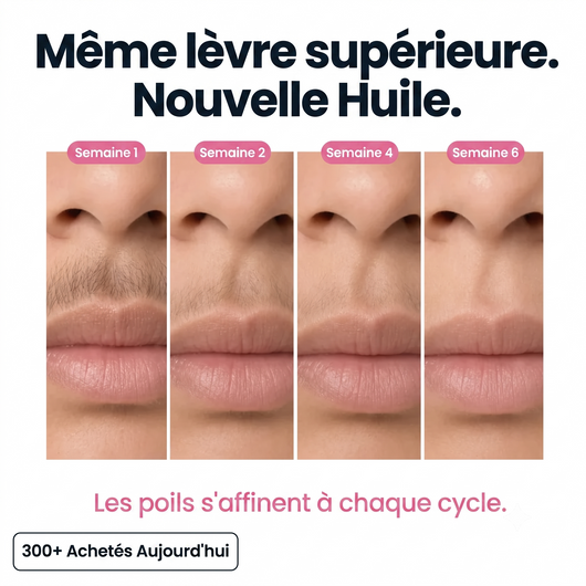 Huile au Cyperus | Repousse Ralentie & Peau Apaisée
